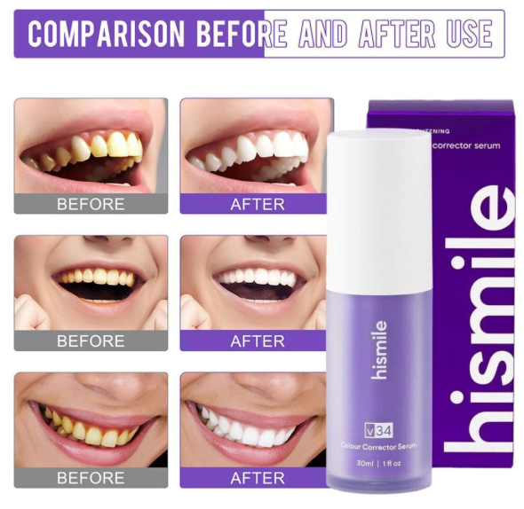 Hismile V34 Colour Corrector Serum – Instant Teeth Brightening Purple Serum (30ml)